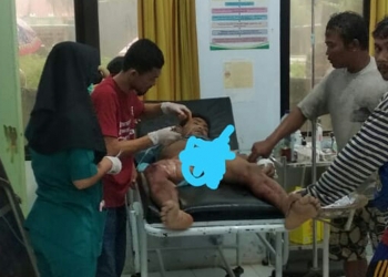 Hujan Lebat, Nelayan Binuangeun Tersambar Petir Saat Nunggu Bangkrak