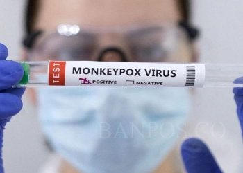 Warga Diminta Tingkatkan Perilaku Hidup Bersih dan Sehat, Dinkes Beri Peringatan Waspada Cacar Monyet