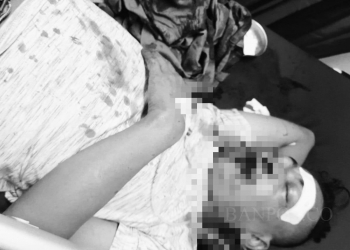 Wartawan Jadi Korban Jalanan Berlubang di Kota Cilegon