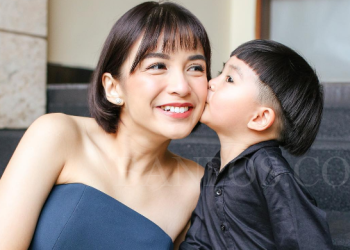 Chelsea Olivia menghilangkan gigi gingsulnya.