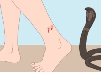 Stok SABU Kosong, Warga Baduy Tewas Akibat Gigitan Ular
